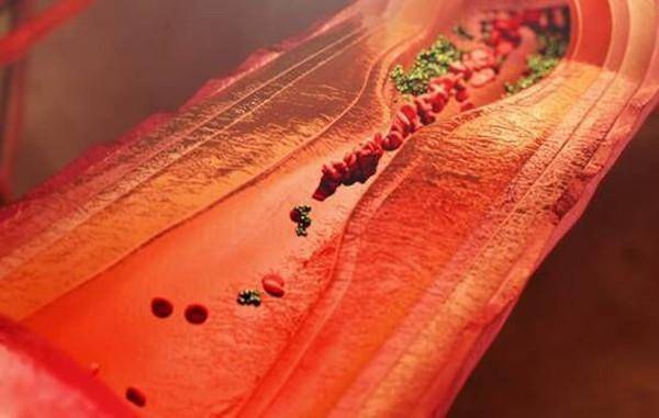 常吃三食物，血管通到底，血栓从此不找你