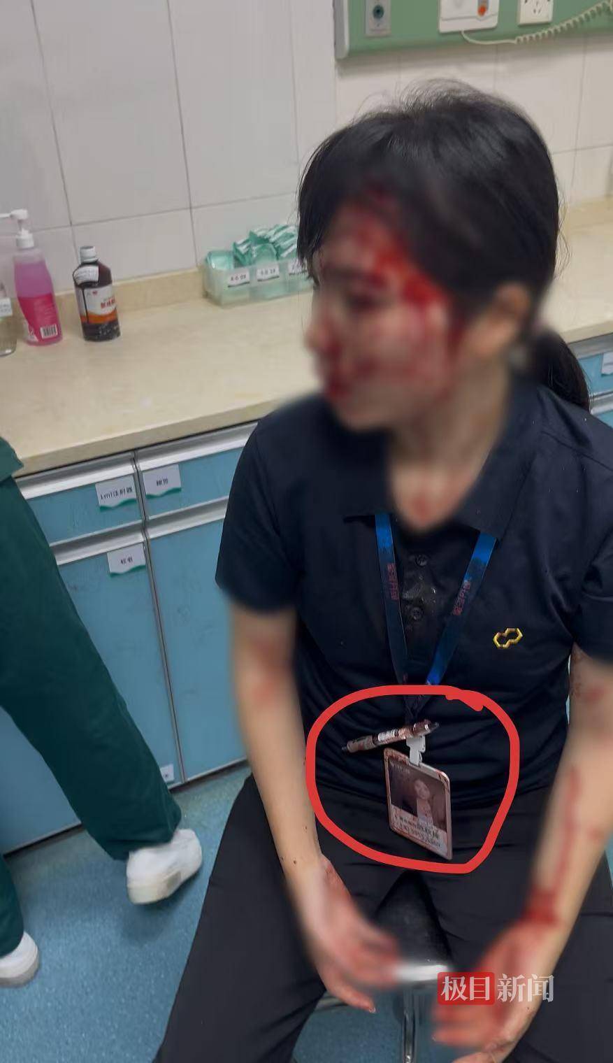 “男子持水杯砸伤女同事被刑拘”后续：脸部缝20多针的女子已出院，否认抢单惹祸