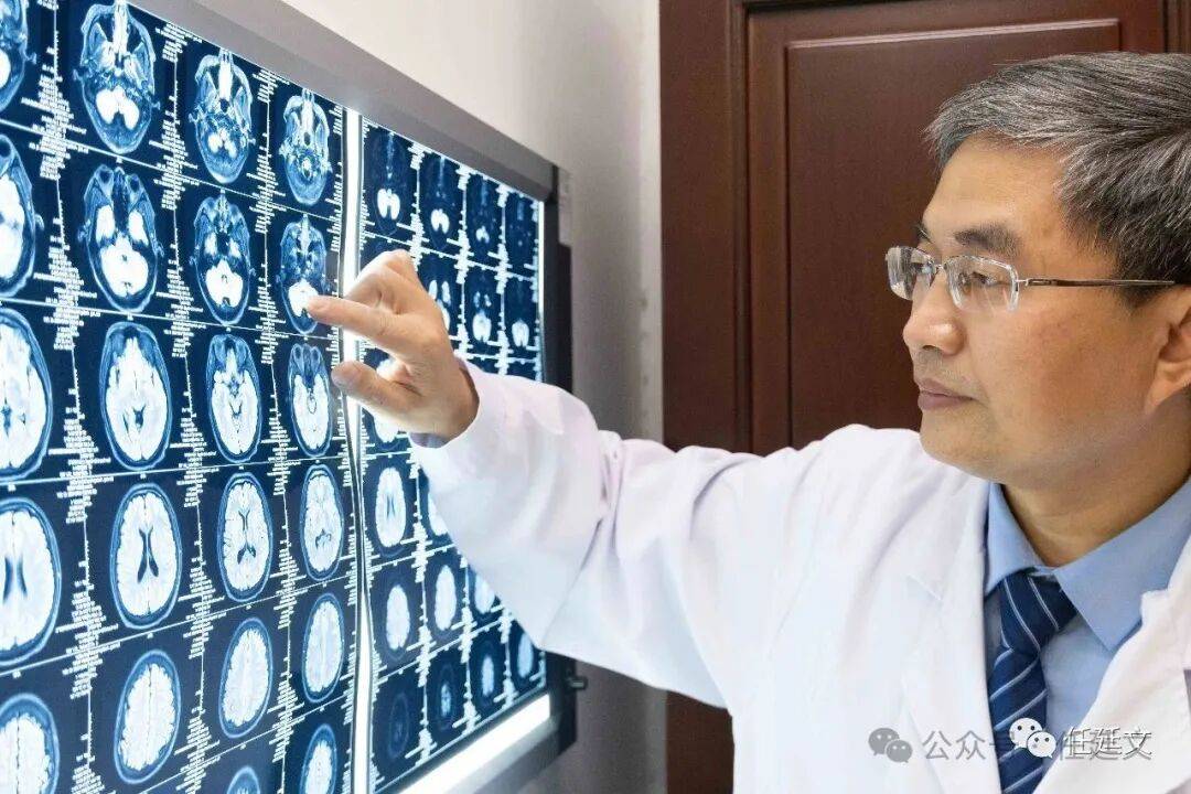 精神分裂症为何越复发越难治？