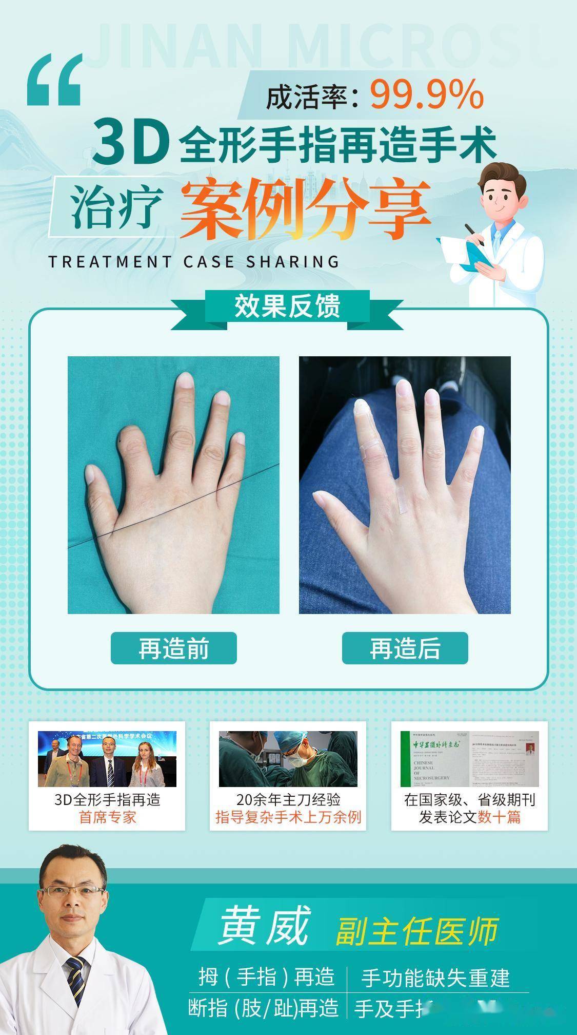 “私人定制”，3D全形手指再造