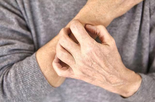 据调查发现：最能加重湿疹的行为，不是吃辣！而是经常去做5件事