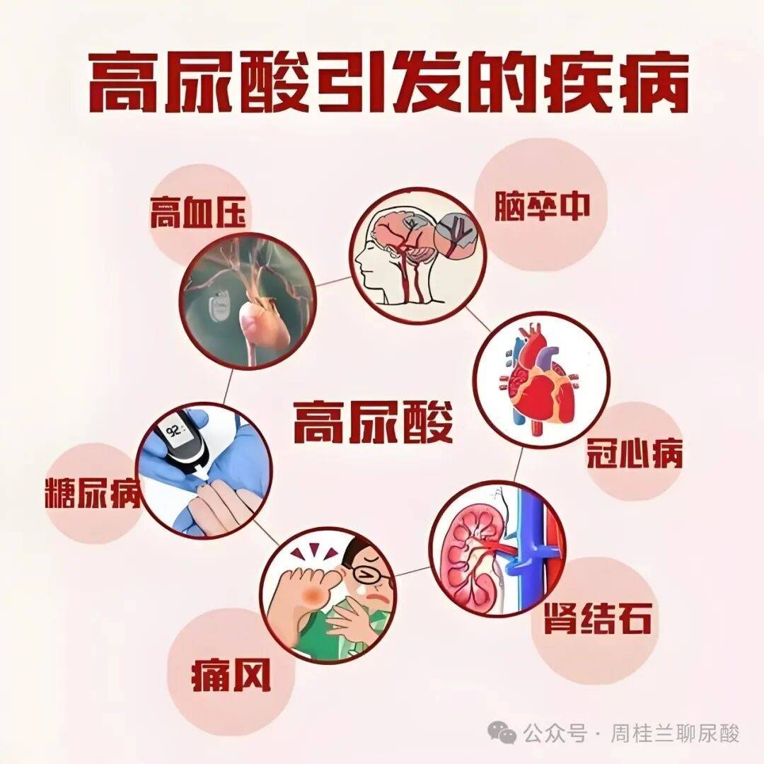 尿酸飙升别慌，做好这3点，代谢回正轨，痛风专家周桂兰来教你！