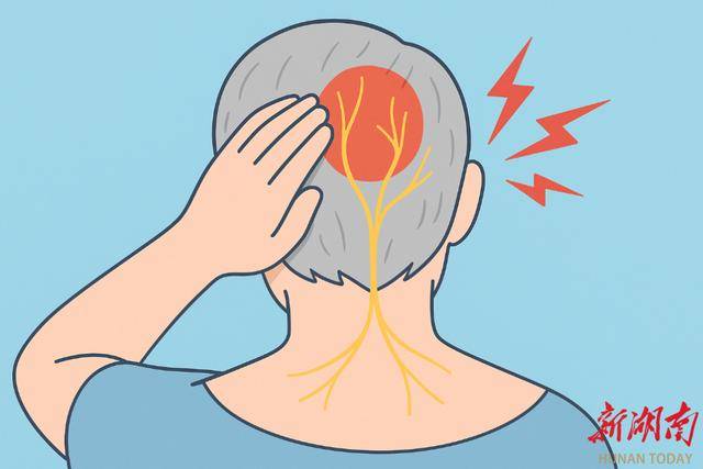 天气变冷，后脑勺老是“扯着疼”？这是枕神经在“报警”