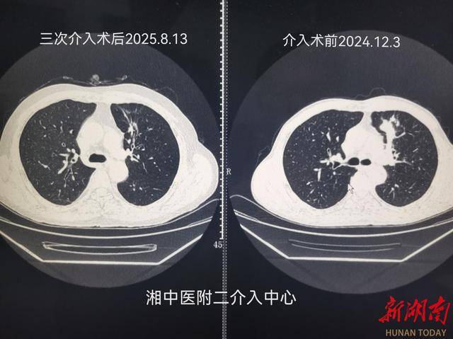 新规引领生物医学创新，筑牢临床研究安全底线