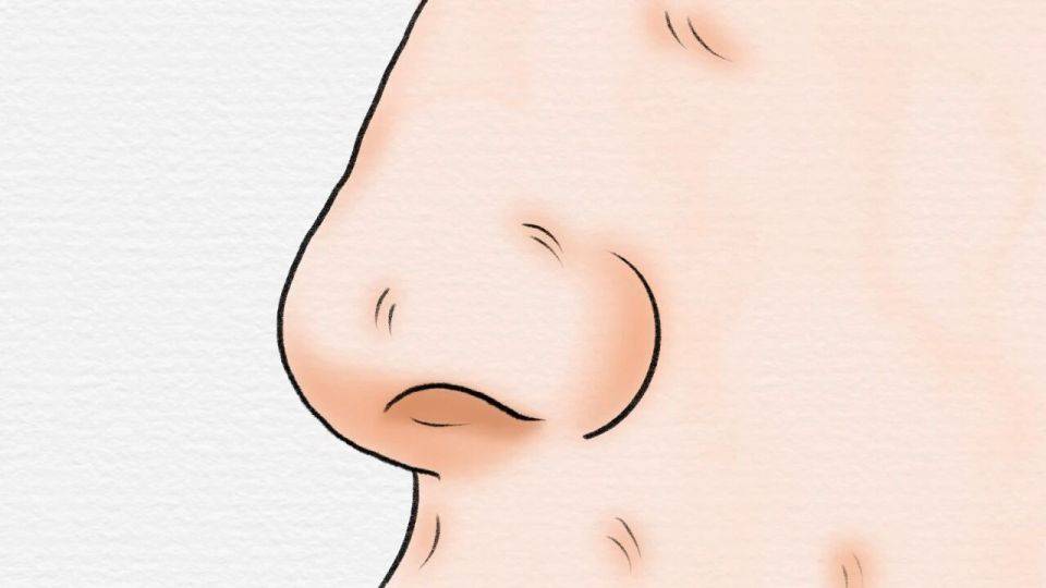 原创            身上长了息肉，需要“一刀切”吗？如何预防息肉的产生？