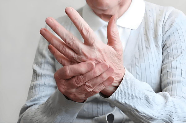 蔡英丽医生：帕金森病是什么原因引起的？如何治疗？