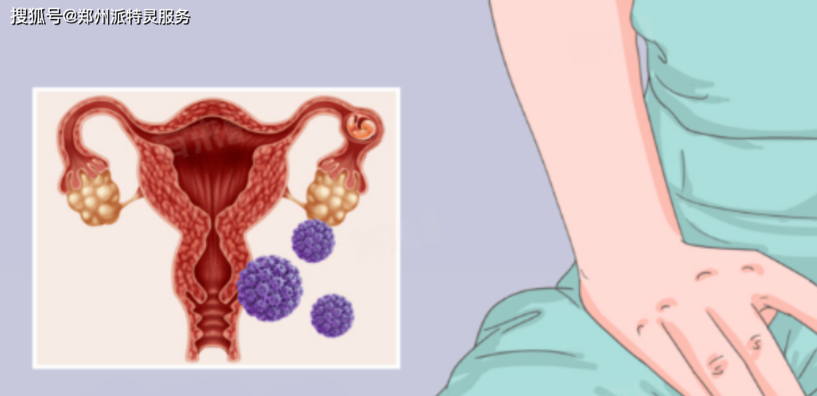 HPV 病毒感染原因及症状