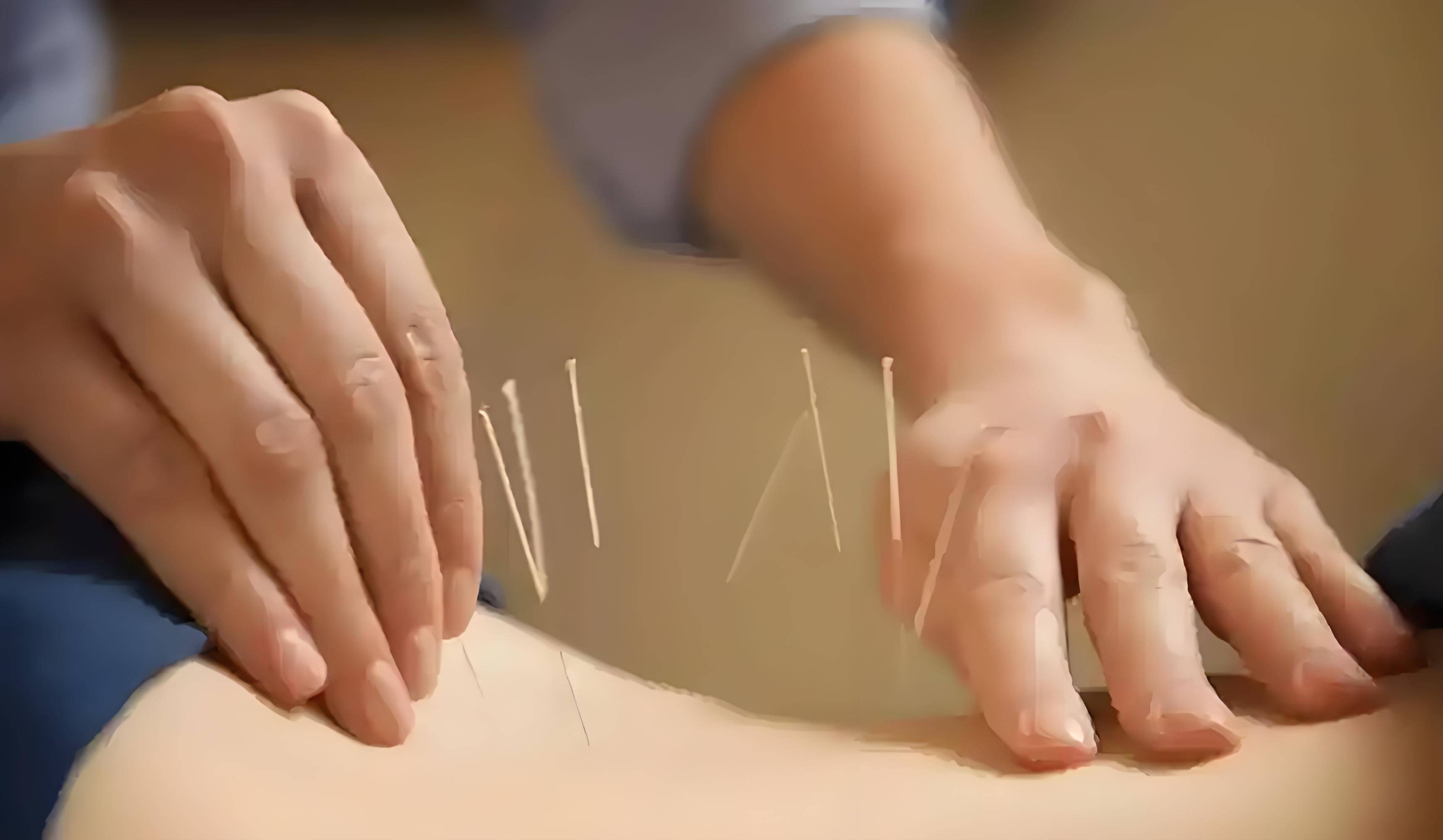 慢性前列腺炎合并阳痿、早泄的中医针灸治疗方法