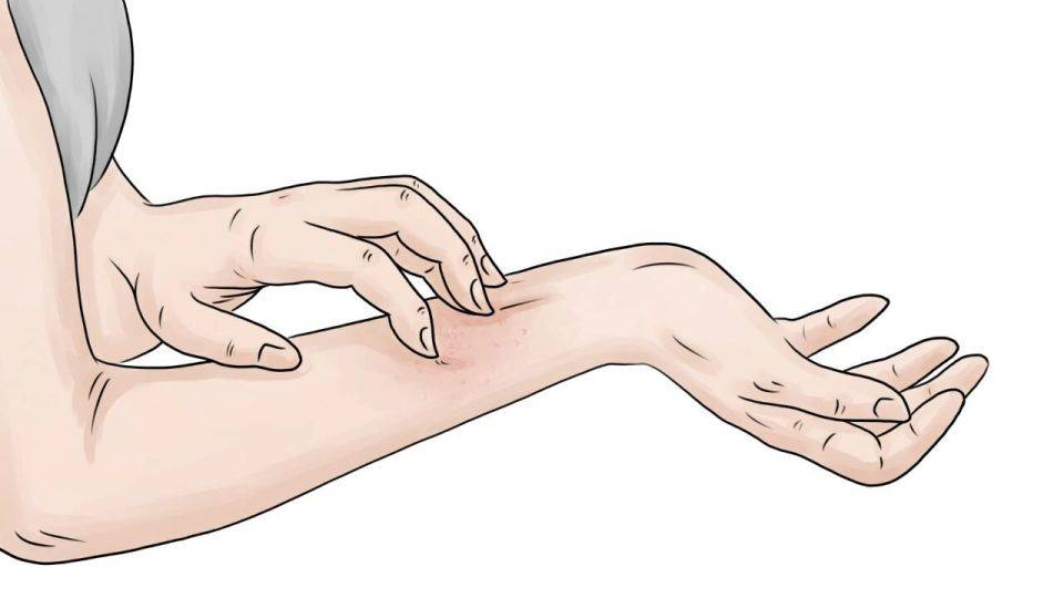 原创            身上突然出现小红点，不要慌，未必是疾病的提示！医生告诉你真相