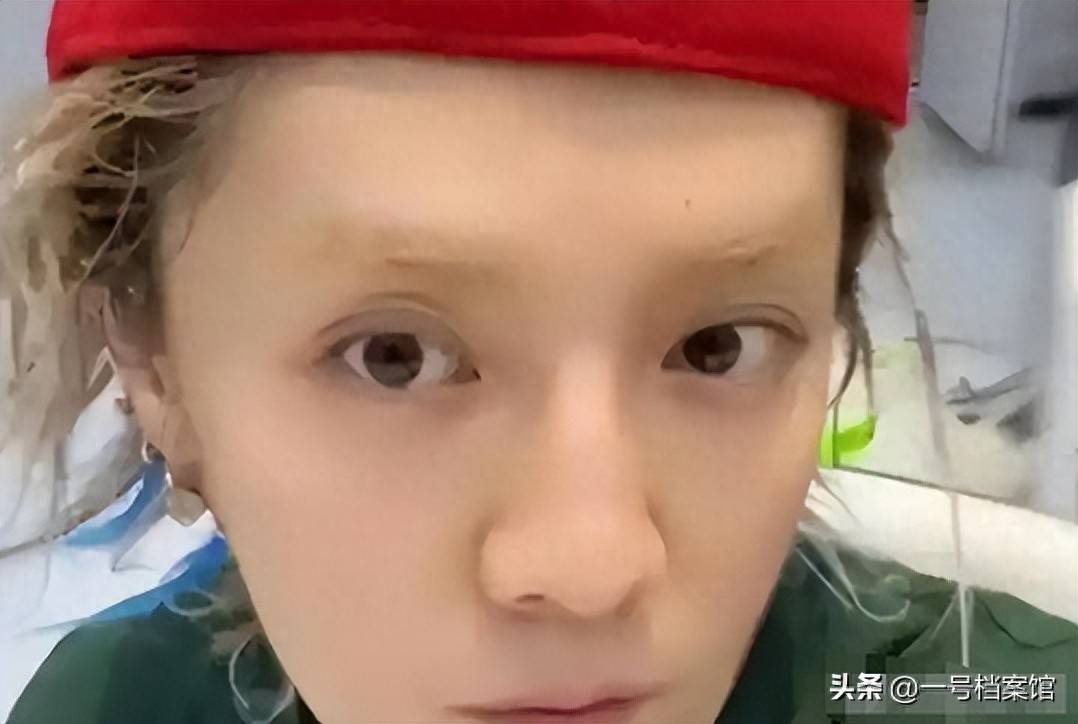 原创            继赵露思鹿晗生病后，白鹿又自曝病情，无力绝望，什么也吃不下