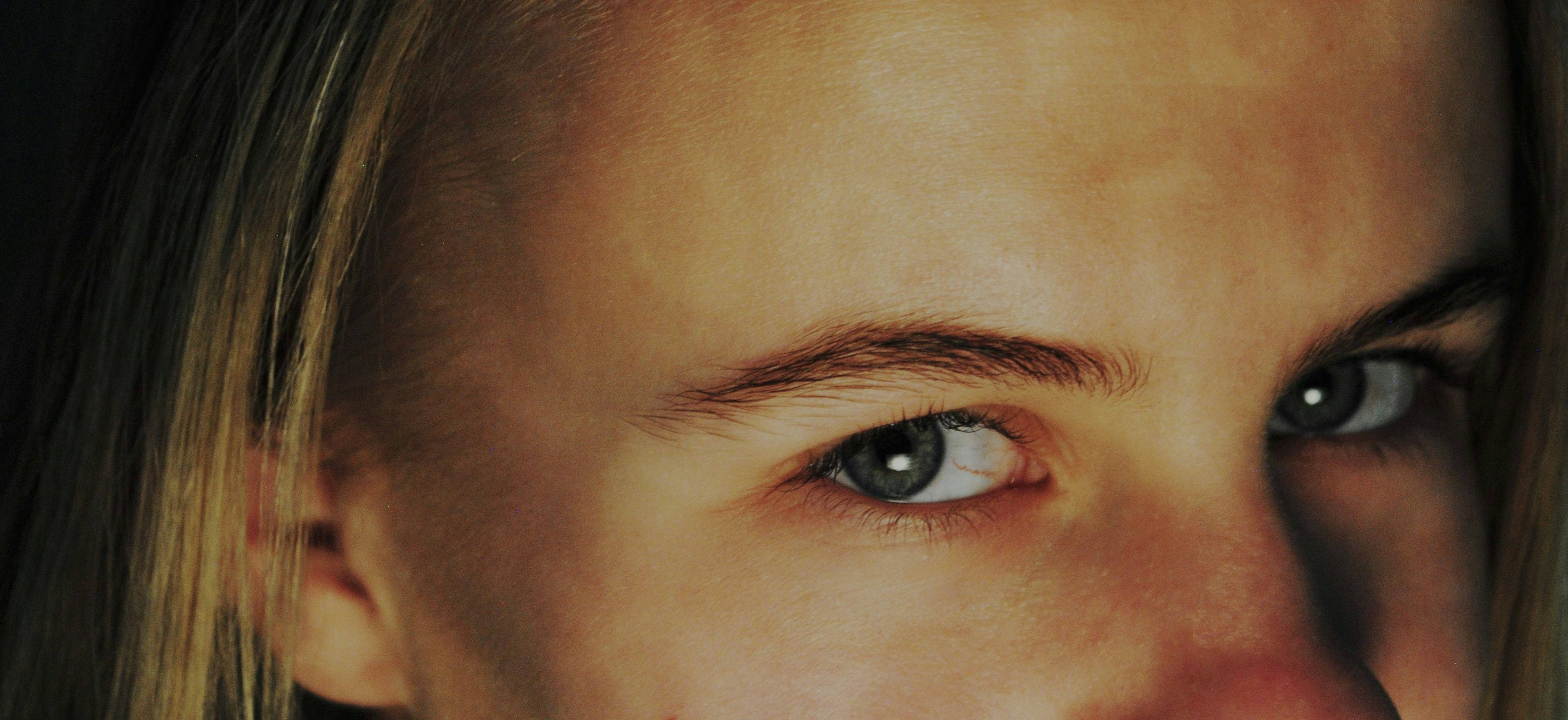 女性必看:黄褐斑不只是美容问题,最新研究揭示真相