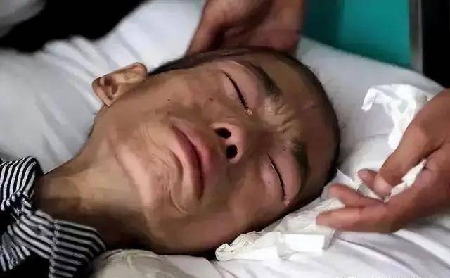 为何患癌人数不断攀升？这些隐藏因素你必须知道