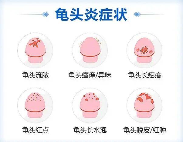 男性生殖感染这件事