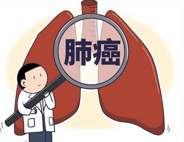 原创            这4种表现或是患上了早期肺癌,却被大多数人忽略!可别再忽视了