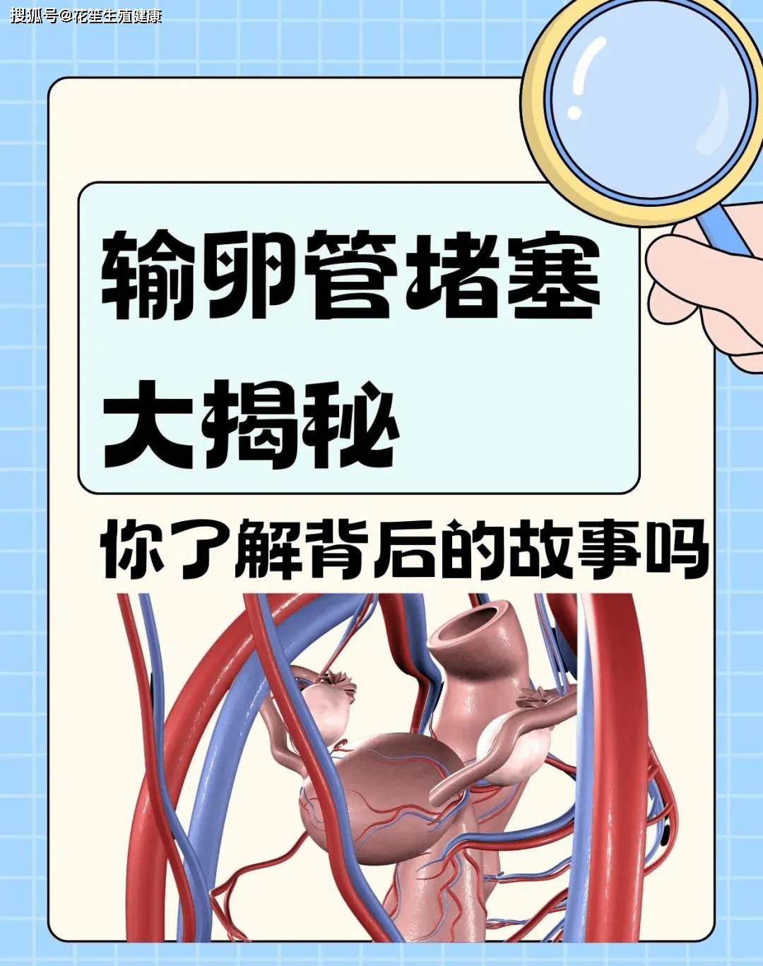 花笙生殖试管分享：当优势卵泡遇上拥堵的输卵管——好孕路上的隐形路障