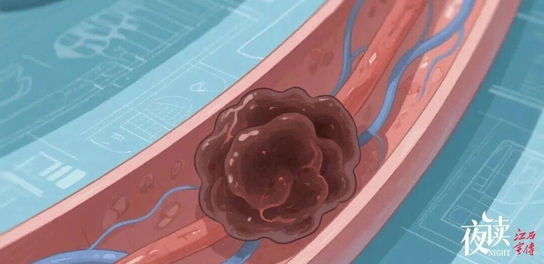 这种秋冬季水果，是真正的“防血栓高手”！