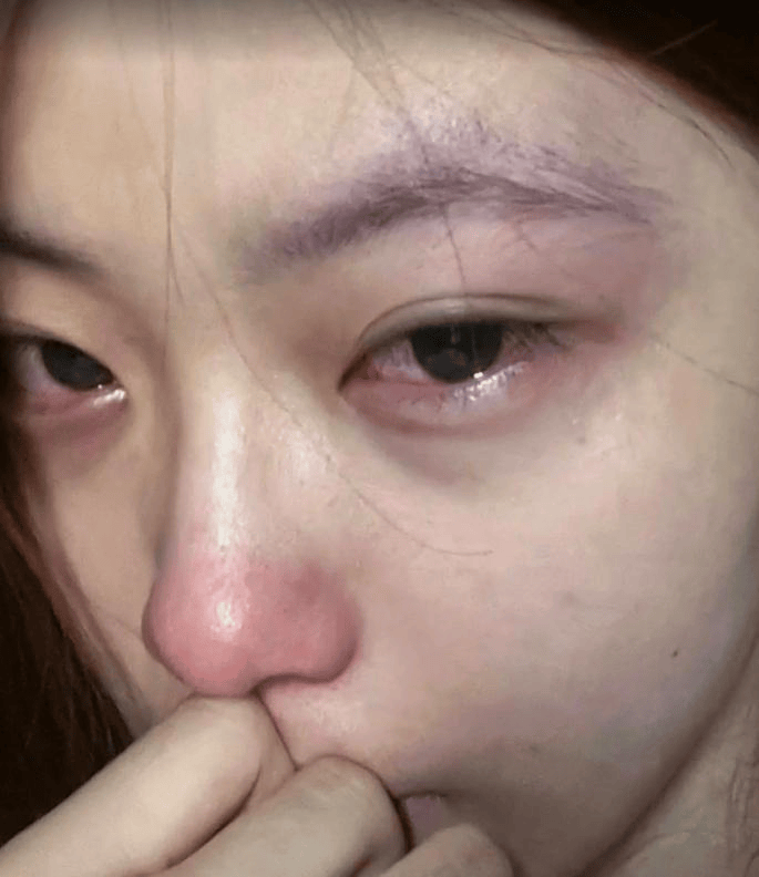 告别“水泥鼻”！轻轻一用就通畅，细腻改善超治愈