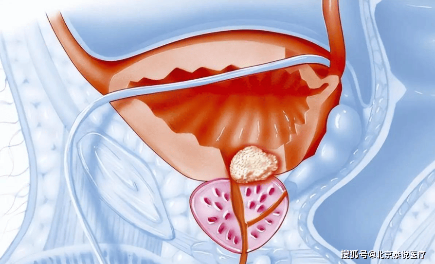 关于勃起角度：你有留意过自己是向上还是向下吗？