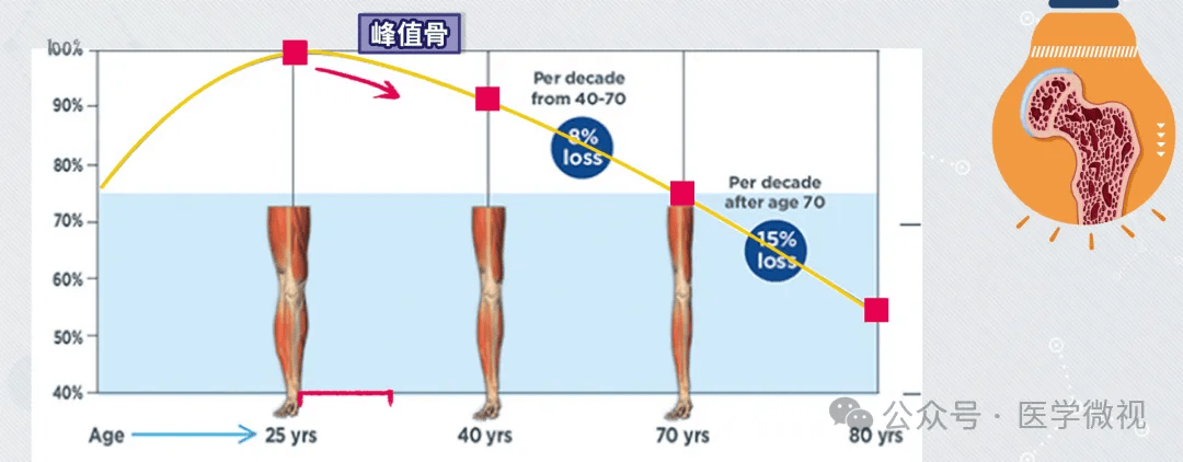骨质疏松日 : 判断骨头缺不缺钙，需要做的竟是这项检测？