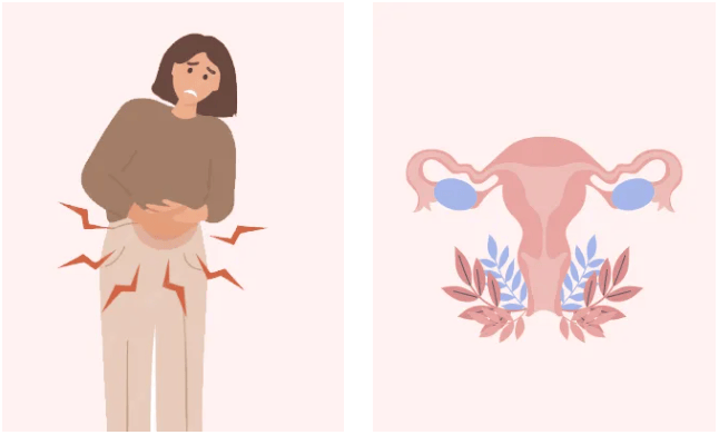 没怀过孕、没流过产…为什么输卵管堵塞/粘连会找上你？