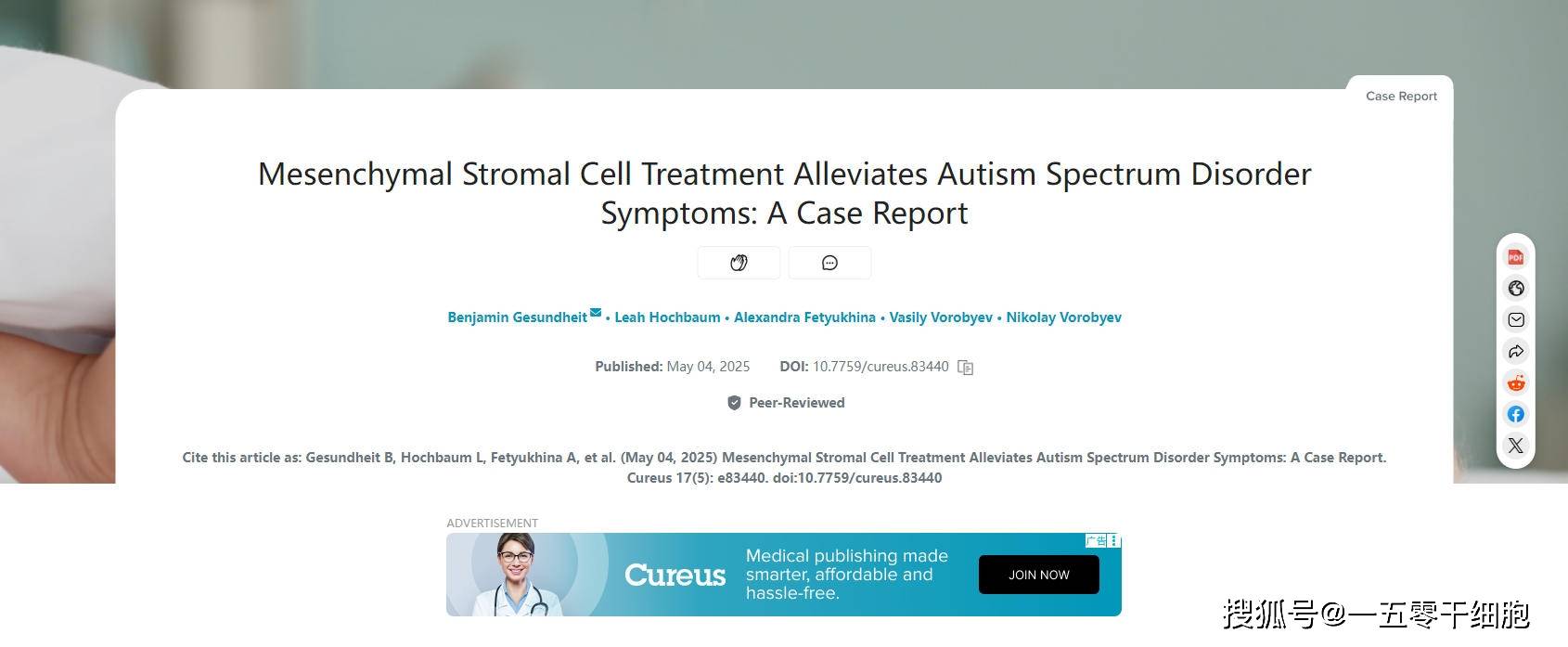 原创            9次干细胞+外泌体治疗:自闭症患儿语言恢复,运动、社交及认知能力显著改善