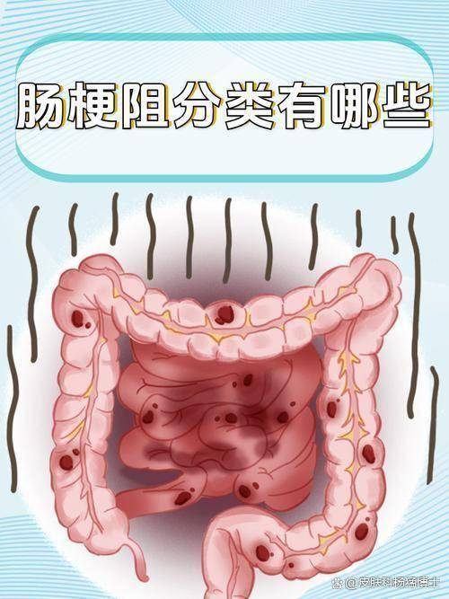 女子连吃好几个柿子致肠梗阻 柿子 皮肤健康,柿子虽甜暗藏肠