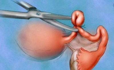 职业环境对男人结扎恢复有何影响