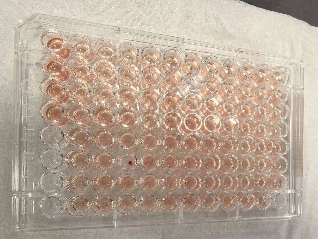 首例！比“熊猫血”罕见百倍，广东顺德发现一例“钻石血”