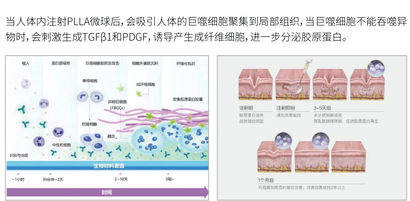 深度解析9款械三童颜的差异：如何选到你的“真命童颜”？