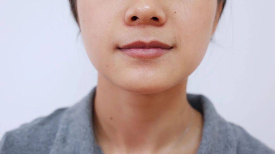 血脂高没高看嘴唇？医生忠告：嘴唇有2个迹象，你的血脂或已超标