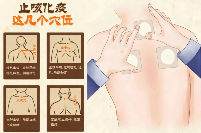 不打针吃药也能治病？揭秘中医外治守护呼吸的四大“秘诀”