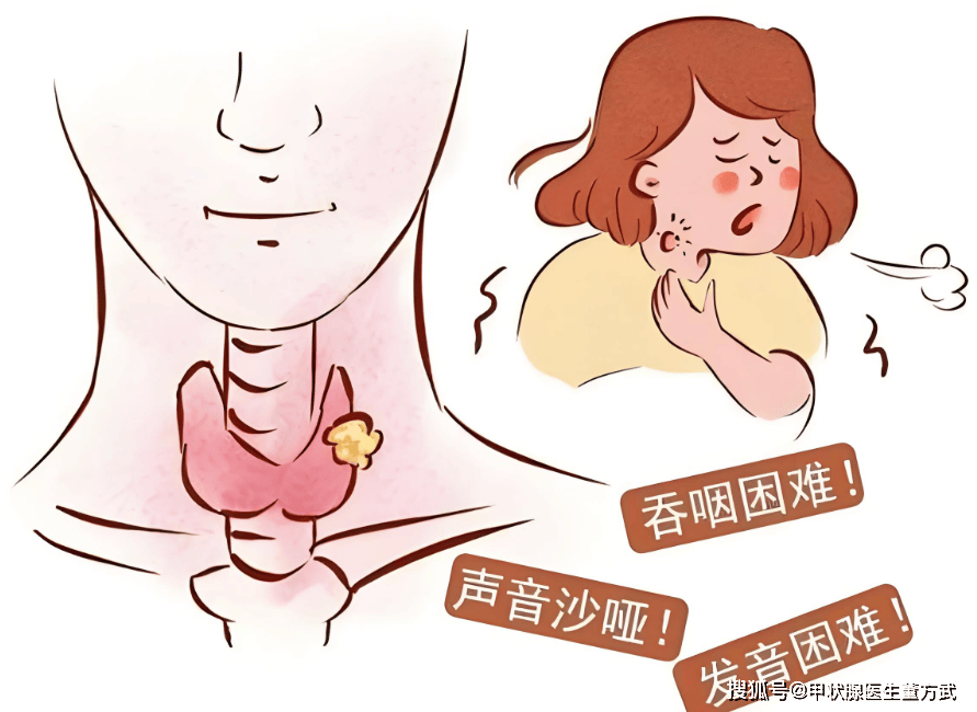 甲状腺“一刀切”后，担心这些后遗症找上门！