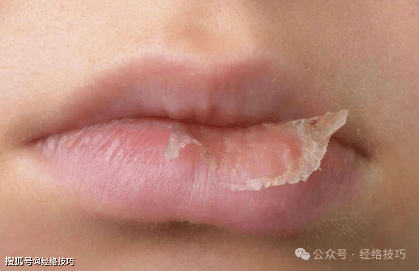 原创            嘴干，可不光是“缺水”那么简单