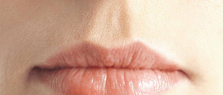 闫玉红健康课堂 | 嘴唇越舔越干？小心唇炎找上门！