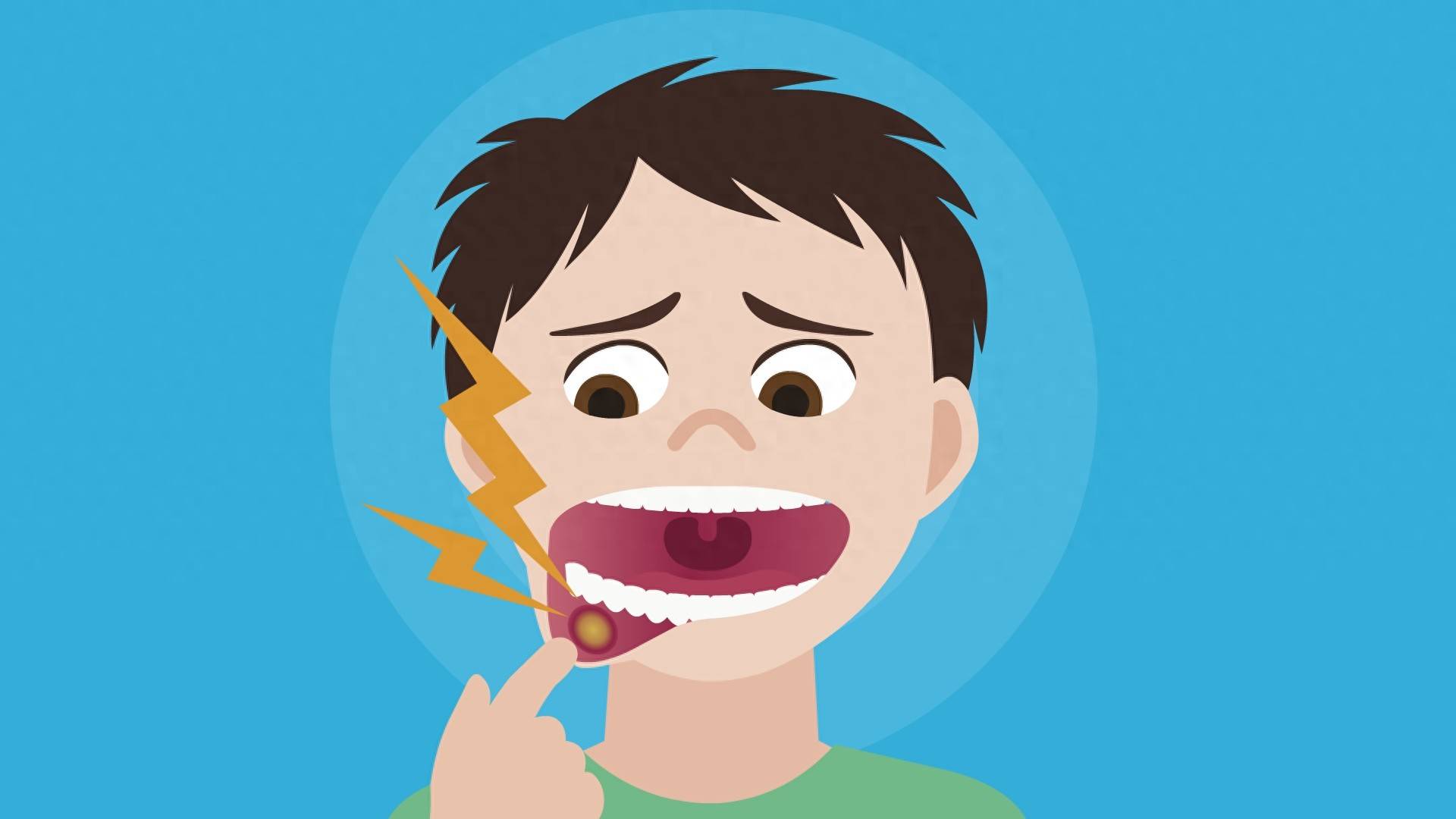 原创            口腔癌早发现至关重要！早期生存率80%以上，晚期不到30%