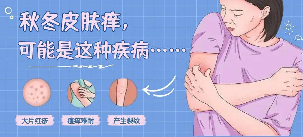 太图百科 | 秋冬皮肤痒，可能是这种疾病……