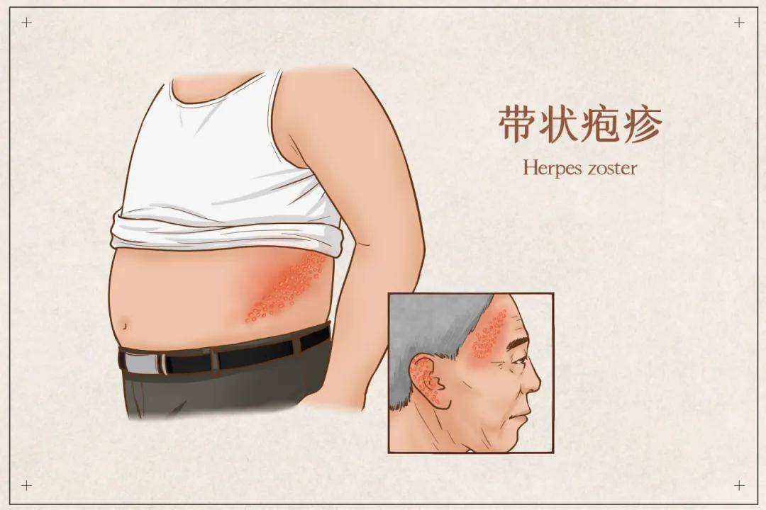 这种神经痛，真的会让人疼哭！