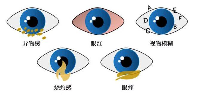 别让 “过度用眼” 熬出干眼！出现这些信号要小心