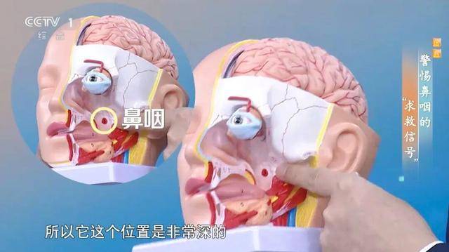 晨起后第一口痰中有血丝别大意！可能是癌症找上了你