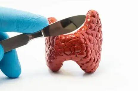 到底是什么引起骨质疏松，原来这才是甲癌后期的最大难题！一文教你解决