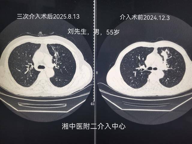 湖南率先开设细胞和基因治疗门诊，精准医疗迈入新纪元