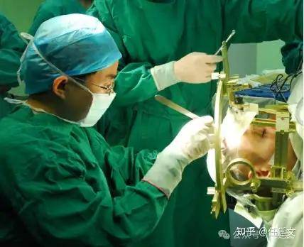 精神分裂症手术治疗：3年病程后的精准破局之路