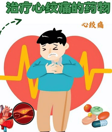 心血管急救药速记：硝酸甘油、速效救心丸等4种药物用法全解析