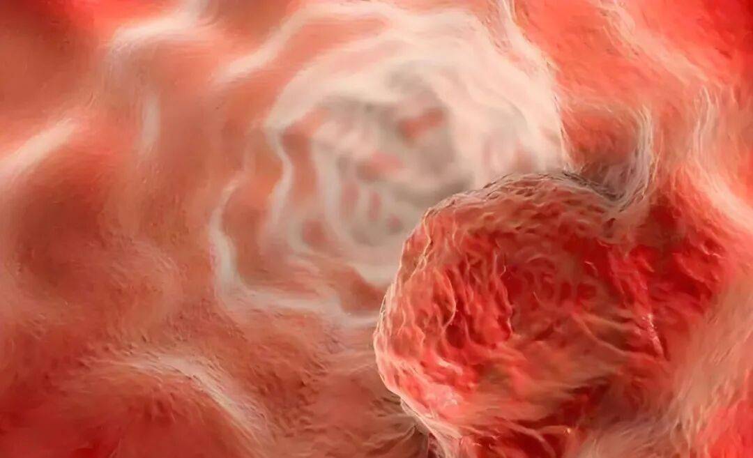 突破耐药困境！中国医学科学院开辟食管鳞癌治疗全新路径