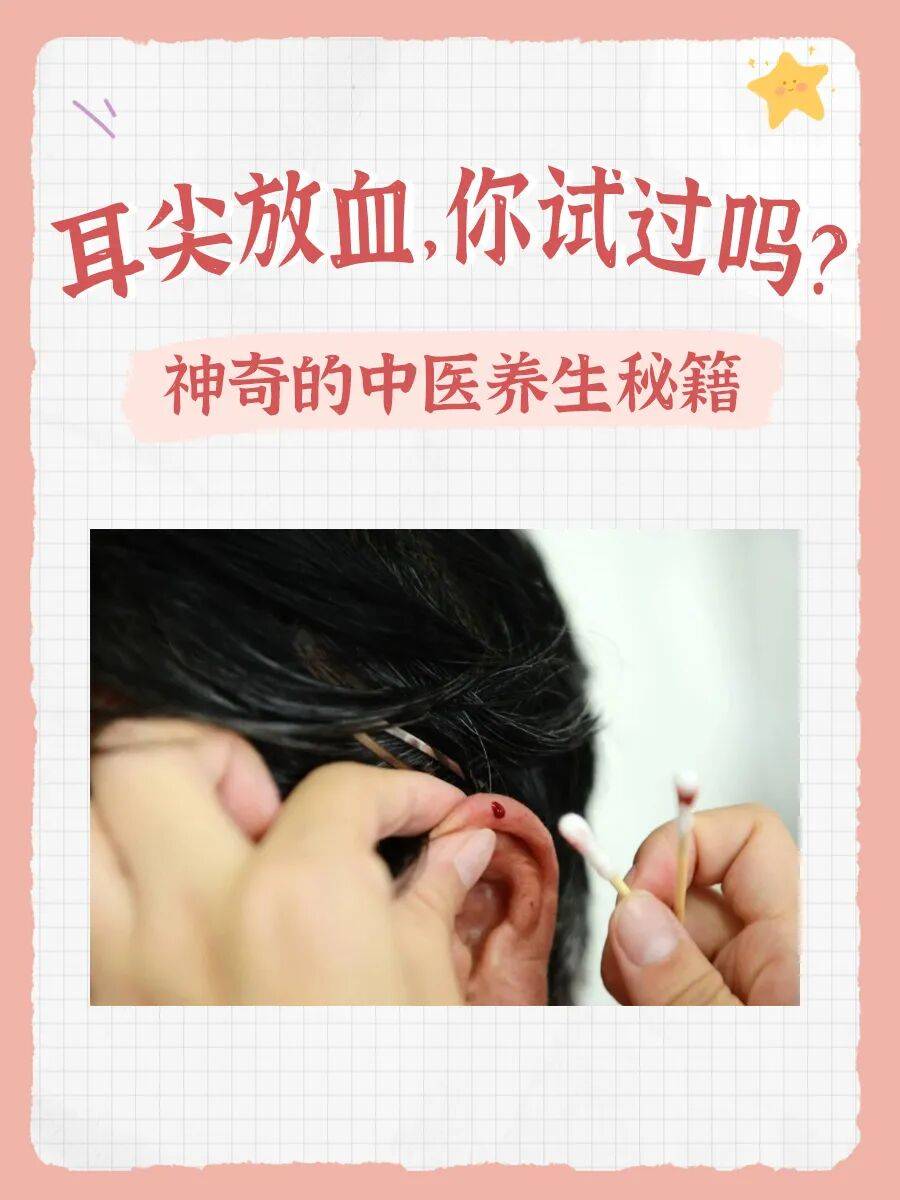 古法焕新，耳尖放血——中医智慧里的“清淤排毒”养生术