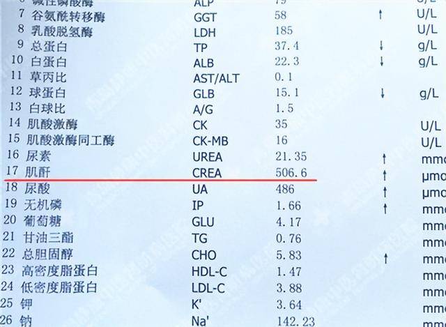 原创            年纪大了，越要重视肌酐？医生：65岁后，肌酐在这2个范围更健康
