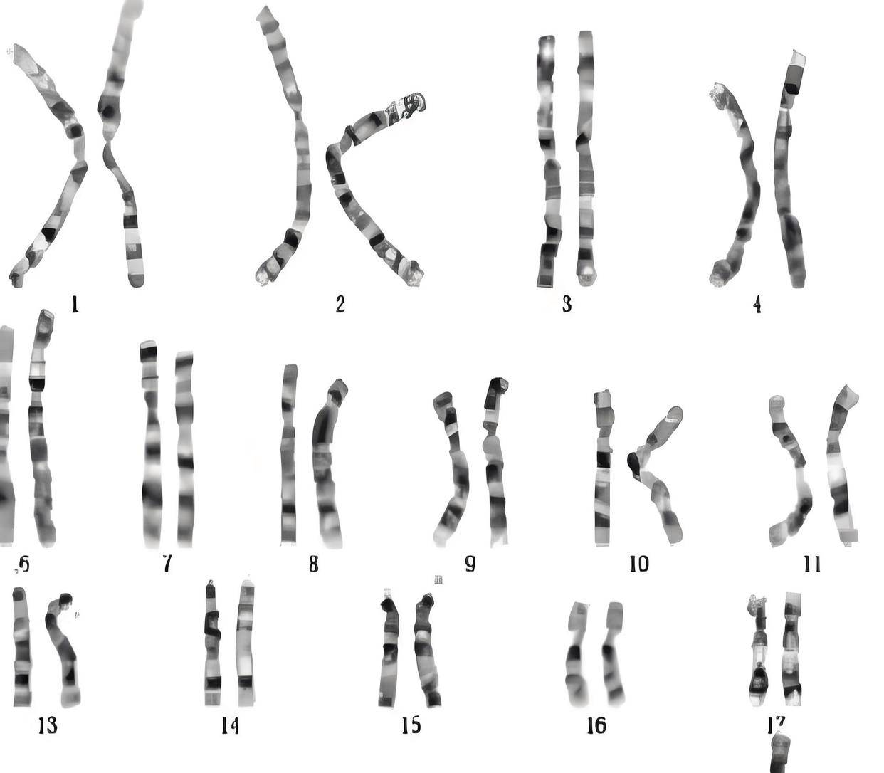 原创            罕见！29岁女子婚后三年不孕，竟被查出男性染色体