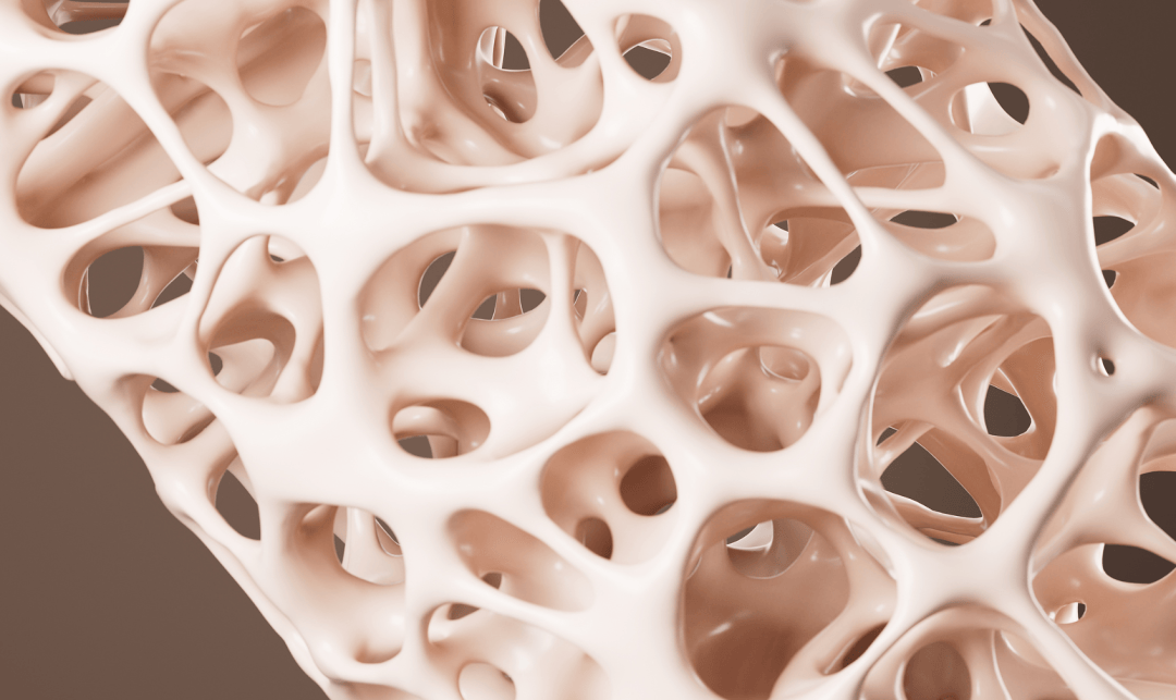 慢病管理医生说｜为您的骨骼“存款”，远离“脆脆骨”人生