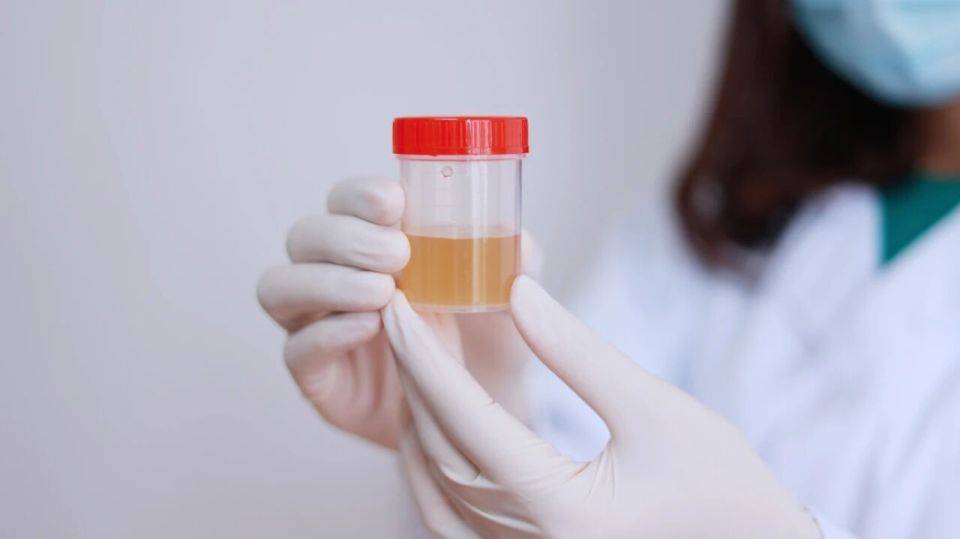 小便出现4个异常，或是寿命缩短的提示，哪怕出现一个，都要重视