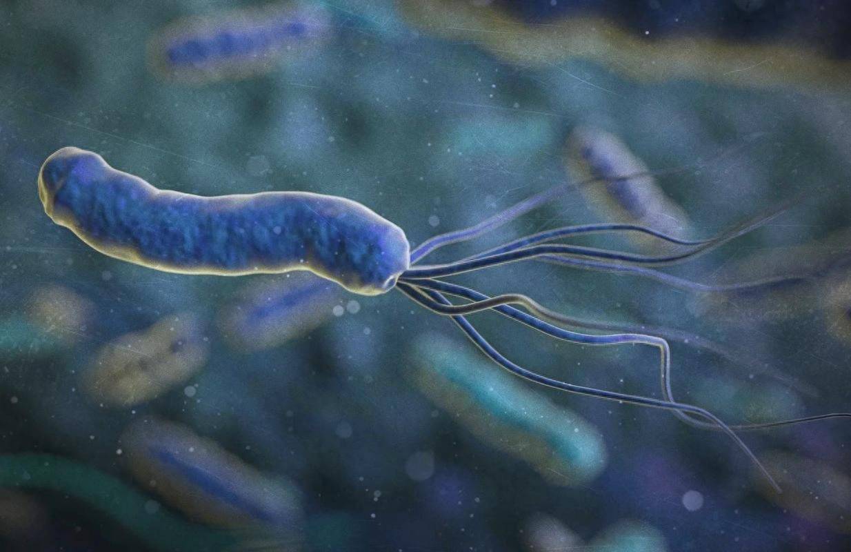 原创            63.4%胃癌由幽门螺旋杆菌导致，一旦感染及时治疗，防止交叉感染